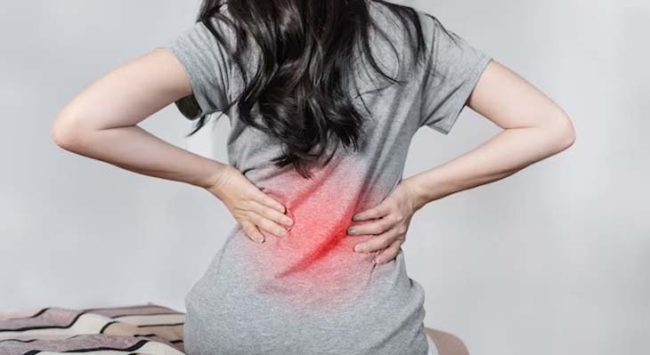 Sciatica