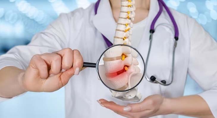 Slipped Disc